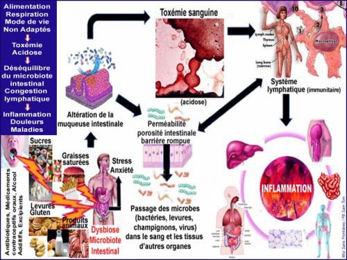 1 inflammation 1