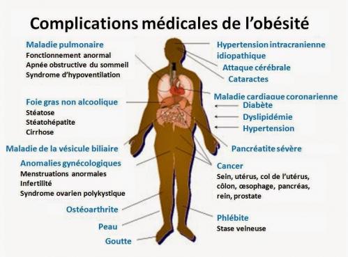 Obesite et complications