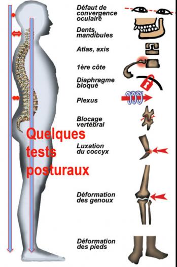 Posturoaxes