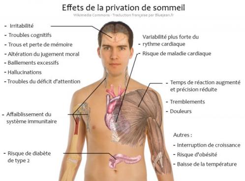 Privation sommeil