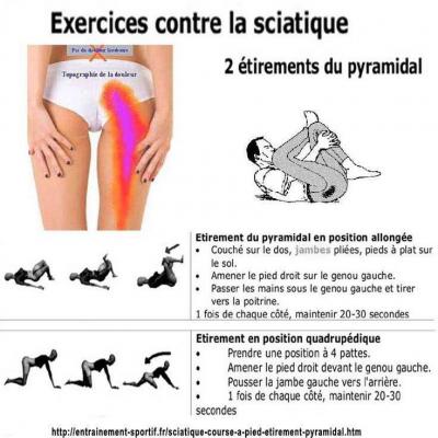 Sciatique 3