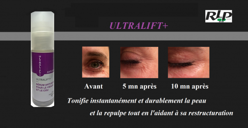 Ultralift 2